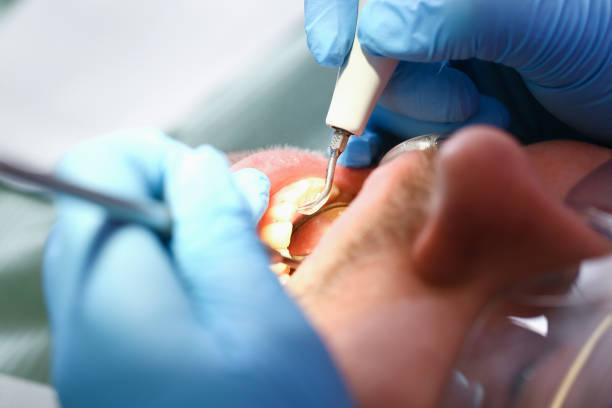Best Emergency Treatment for Jaw Pain or Injury in Greenville, SC